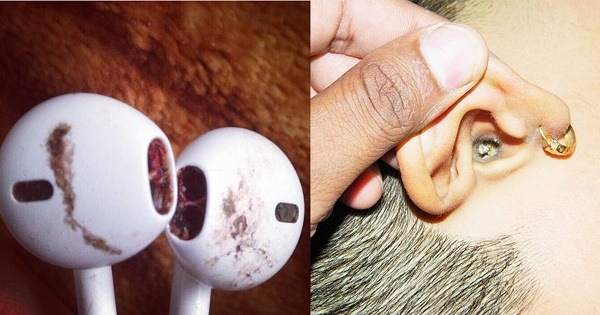 Hậu quả khôn lường khi sử dụng tai nghe giả Hậu quả khôn lường khi sử dụng tai nghe giả